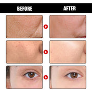 Cleanse Facial Skin With Deep Anti-wrinkle